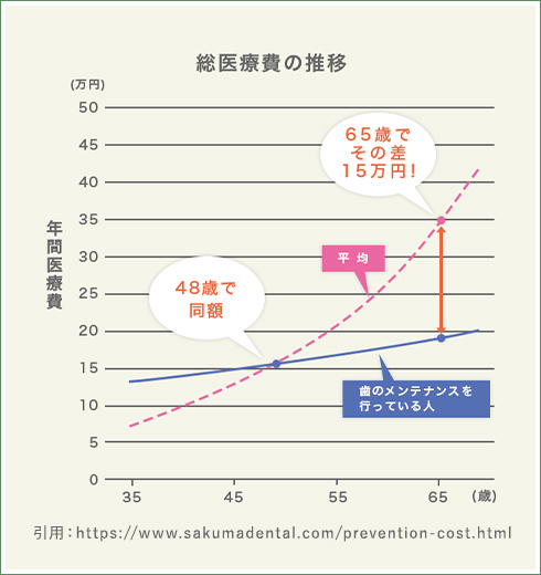 歯の予防が大切な理由